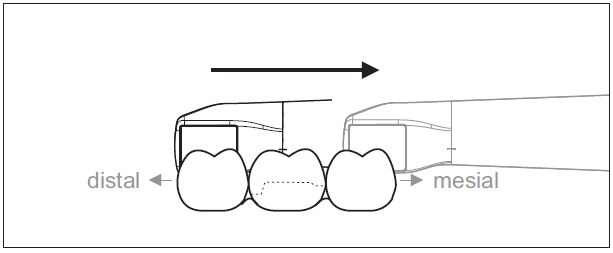 CEREC AC OMNICAM ПРОСТОЕ СКАНИРОВАНИЕ БЕЗ АНТИБЛИКОВОГО СПРЕЯ 10.jpg