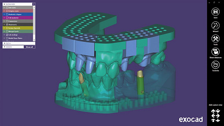 Exocad Model Creator - модуль создания моделей