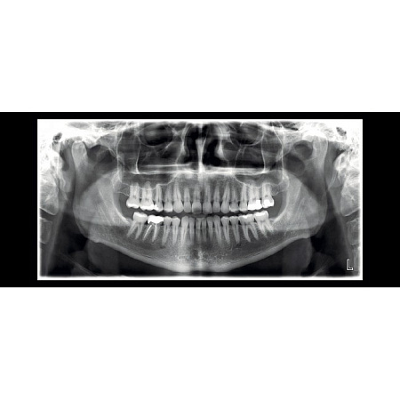 Planmeca ProMax 2D SCARA 3 - рентгеновская установка без цефалостата