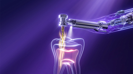 Woodpecker Endo GT Pro — Эндомотор с автоматическим определением крутящего момента и встроенным апекслокатором
