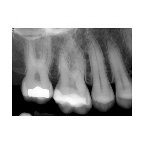 Suni SuniRay2 - система компьютерной радиовизиографии