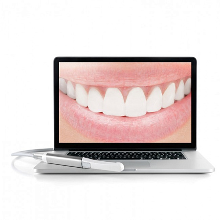 KaVo C-U2 - интраоральная камера высокого разрешения